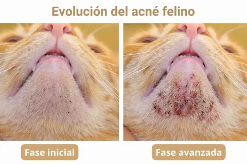 Evolución del acné felino: fase inicial con puntos negros y fase avanzada con inflamación. Un posible tratamiento casero podría ayudar.